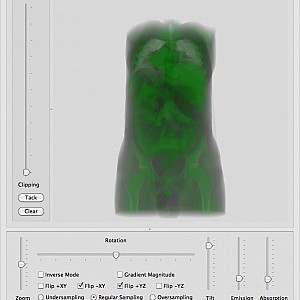 CT-Abdomen1