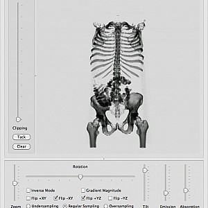 CT-Abdomen2